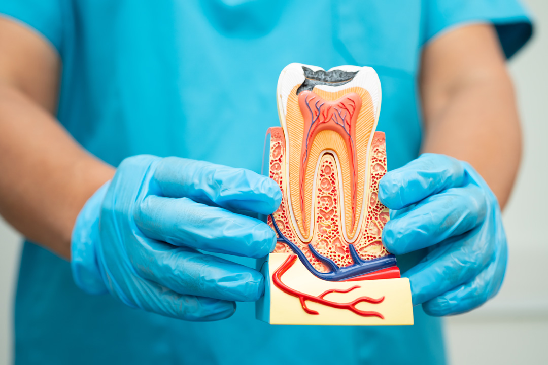 Root Canals 1 asian dentist holding dental implant artificial t 2025 02 25 22 38 15 utc
